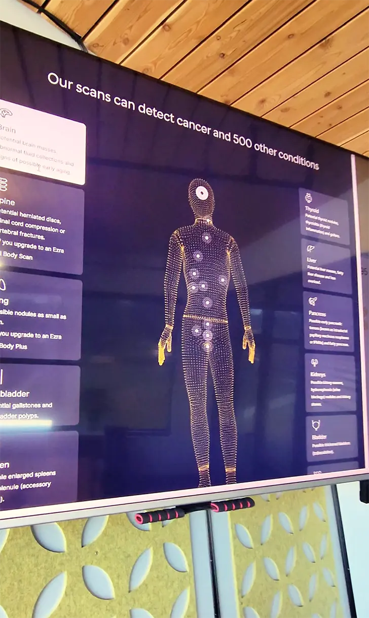 Body scan diagram showing areas screened