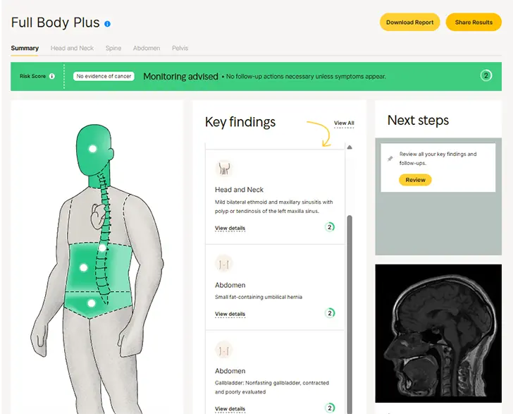 Ezra Full Body Plus scan results with key MRI findings and next steps