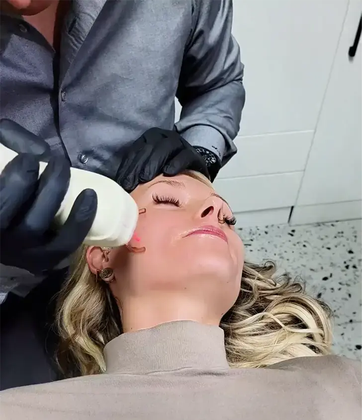 Dr. Unal Performing CO₂ Laser Treatment